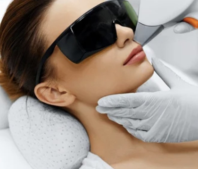 Séance de dépilation laser, lunettes de protection
